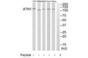 Western blot analysis of extracts from HeLa cells, A549 cells, K562 cells, COLO205 cells and NIH-3T3 cells, using ATN1 antibody. (Atrophin 1 Antikörper  (N-Term))
