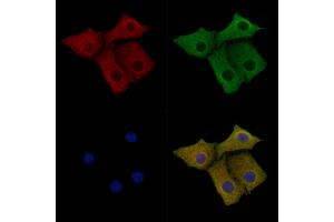 ABIN6262128 and ABIN6279462 staining Hela cells by IF/ICC.
