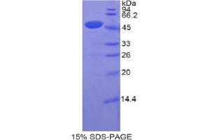 SDS-PAGE analysis of Human CDNF Protein. (CDNF Protein)