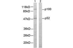 Western blot analysis of extracts from ovary cancer cells, using NF-kappaB p100/p52 (Ab-865) Antibody. (NFKB2 Antikörper  (AA 833-882))