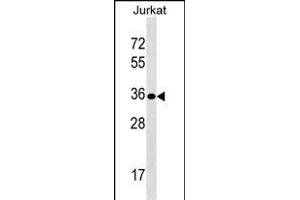 UPK3B Antibody (Center) (ABIN1538017 and ABIN2849255) western blot analysis in Jurkat cell line lysates (35 μg/lane). (Uroplakin 3B Antikörper  (AA 192-219))