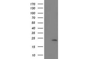Western Blotting (WB) image for anti-Superoxide Dismutase 2, Mitochondrial (SOD2) antibody (ABIN1499530) (SOD2 Antikörper)