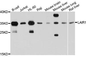 Western blot analysis of extracts of various cell lines, using LAIR1 antibody (ABIN6003818) at 1/1000 dilution. (LAIR1 Antikörper)