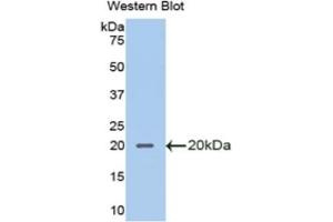 Detection of Recombinant SLPI, Mouse using Polyclonal Antibody to Secretory Leukocyte Peptidase Inhibitor (SLPI) (SLPI Antikörper  (AA 20-131))