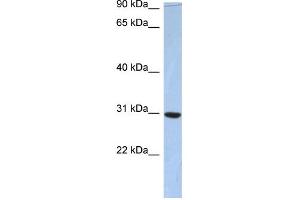 WB Suggested Anti-C16orf65 Antibody Titration: 0. (PDZD9 Antikörper  (Middle Region))