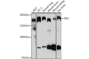 Western blot analysis of extracts of various cell lines, using Slit2 Rabbit mAb (ABIN7270335) at 1:1000 dilution. (SLIT2 Antikörper)