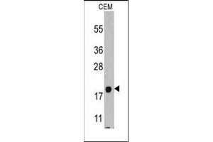 Western Blotting (WB) image for anti-Pro-Platelet Basic Protein (Chemokine (C-X-C Motif) Ligand 7) (PPBP) (AA 99-128), (C-Term) antibody (ABIN359713)
