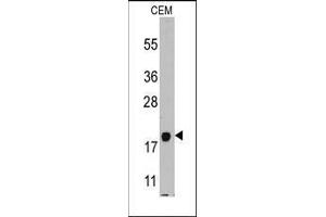 Western blot analysis of anti-PPBP Pab in CEM cell line lysates (35ug/lane). (CXCL7 Antikörper  (C-Term))