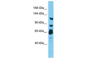 Host:  Rabbit  Target Name:  RNF213  Sample Type:  Thyroid Tumor lysates  Antibody Dilution:  1. (RNF213 Antikörper  (N-Term))