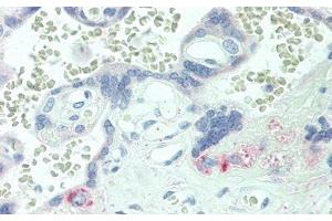 Immunohistochemistry (IHC) image for anti-Intercellular Adhesion Molecule 4 (ICAM4) (AA 23-227) antibody (ABIN7443041)