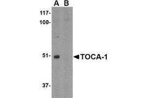 Western blot analysis of TOCA-1 in mouse brain tissue lysate with in (A) the absence and (B) the presence of blocking peptide with this product at 1 μg/ml. (FNBP1L Antikörper  (C-Term))