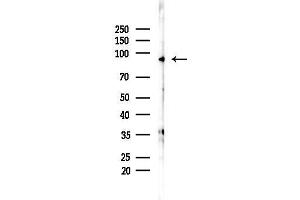 Western blot analysis of lysates from F10-LUC cells(LPS,4h treatment), using EXOSC10 Antibody at 1/1000 dilution.