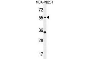 Western Blotting (WB) image for anti-Phosphodiesterase 12 (PDE12) antibody (ABIN2995597) (PDE12 Antikörper)