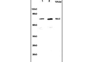 Lane 1: rat brain lysates Lane 2: mouse embryo lysates probed with Anti CKAP4 Polyclonal Antibody, Unconjugated  at 1:200 in 4˚C. (CKAP4 Antikörper  (AA 525-602))