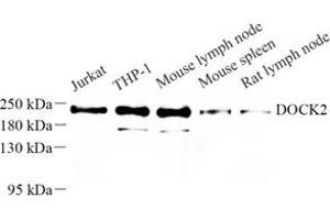 Western blot analysis of DOCK2 (ABIN7073706) at dilution of 1: 500 (DOCK2 Antikörper)