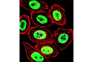 Fluorescent confocal image of  cell stained with EWSR1 Antibody (C-term) (ABIN652770 and ABIN2842507). (EWSR1 Antikörper  (C-Term))