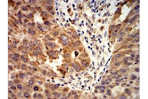 Immunohistochemistry (IHC) image for anti-Activin Receptor Type I (ACRV1) (AA 21-120) antibody (ABIN5611297)