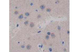 Used in DAB staining on fromalin fixed paraffin- embedded brain tissue (Glutaminase Antikörper  (AA 31-253))