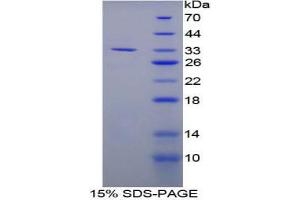 SDS-PAGE analysis of Mouse LOX1 Protein. (OLR1 Protein)