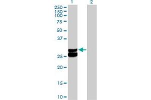 Western Blot analysis of ECHS1 expression in transfected 293T cell line by ECHS1 MaxPab polyclonal antibody. (ECHS1 Antikörper  (AA 1-290))