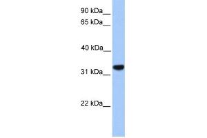 WB Suggested Anti-CACNG4 Antibody Titration:  0. (CACNG4 Antikörper  (N-Term))