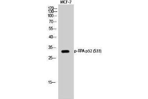 Western Blotting (WB) image for anti-Replication Protein A2, 32kDa (RPA2) (pSer33) antibody (ABIN3182369)