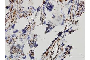 Immunoperoxidase of monoclonal antibody to DKK1 on formalin-fixed paraffin-embedded human placenta. (DKK1 Antikörper  (AA 1-266))