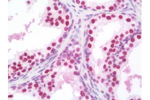 Anti-SSB / La antibody IHC staining of human prostate. (SSB Antikörper)