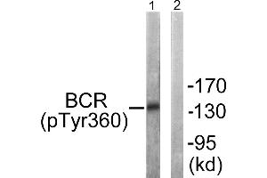Immunohistochemistry analysis of paraffin-embedded human brain tissue using Bcr (Phospho-Tyr360) antibody. (BCR Antikörper  (pTyr360))