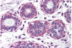 Human Breast (formalin-fixed, paraffin-embedded) stained with NET1 antibody ABIN299308 at 2. (NET1 Antikörper  (AA 396-409))