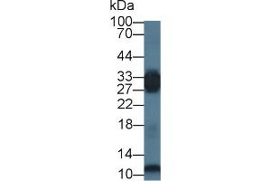 Western blot analysis of Mouse Skeletal muscle lysate, using Human PGAM2 Antibody (1 µg/ml) and HRP-conjugated Goat Anti-Rabbit antibody ( (PGAM2 Antikörper  (AA 1-236))