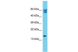 Host: Rabbit Target Name: C12orf65 Sample Type: Jurkat Whole Cell lysates Antibody Dilution: 1.