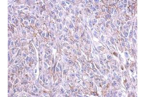 Immunohistochemistry (IHC) image for anti-Corticotropin Releasing Hormone Receptor 1 (CRHR1) (N-Term) antibody (ABIN2854642)