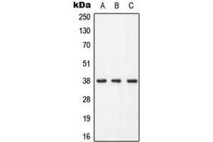 Western blot analysis of LAT (pY255) expression in HEK293T (A), Raw264. (LAT Antikörper  (C-Term, pTyr255))