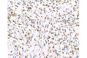 IHC analysis of Giantin/GOLGB1 using anti-Giantin/GOLGB1 antibody (ABIN7600139). (Golgin B1 (GOLGB1) (AA 153-950) Antikörper)