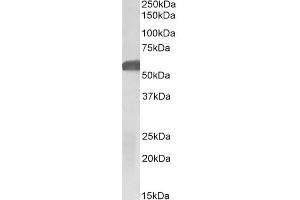 ABIN5539774 (1µg/ml) staining of Human Hippocampus lysate (35µg protein in RIPA buffer). (GLP1R Antikörper  (Internal Region))