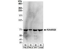 anti-Pumilio RNA Binding Family Member 3 (PUM3) (AA 1-50) antibody