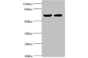 Western blot All lanes: CROT antibody at 3 μg/mL Lane 1: Mouse kidney tissue Lane 2: A431 whole cell lysate Secondary Goat polyclonal to rabbit IgG at 1/10000 dilution Predicted band size: 71, 11, 74 kDa Observed band size: 71 kDa (CROT Antikörper  (AA 1-87))
