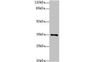 Western blot All lanes: MED27 antibody at 0. (MED27 Antikörper  (AA 39-108))