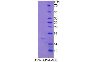 SDS-PAGE analysis of Human NCR3 Protein. (NCR3 Protein)