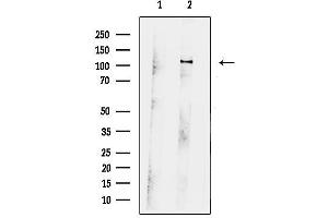 anti-Synaptopodin 2 (SYNPO2) (Internal Region) antibody