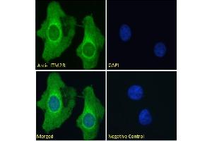 ABIN570955 Immunofluorescence analysis of paraformaldehyde fixed HeLa cells, permeabilized with 0.