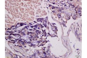 Immunohistochemistry (Paraffin-embedded Sections) (IHC (p)) image for anti-Colony Stimulating Factor 1 (Macrophage) (CSF1) (AA 201-300) antibody (ABIN1387727)