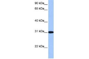 WB Suggested Anti-RFPL2 Antibody Titration: 0. (RFPL2 Antikörper  (C-Term))