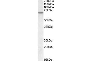 ABIN184636 (1µg/ml) staining of Human Skeletal Muscle lysate (35µg protein in RIPA buffer). (MTM1 Antikörper  (C-Term))