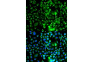 Immunofluorescence analysis of A549 cells using EPHA1 antibody (ABIN6290349). (EPHA1 Antikörper)