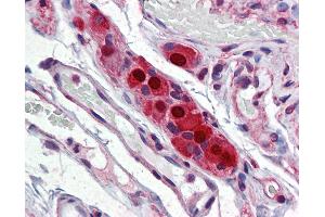 Immunohistochemistry (IHC) image for anti-ELAV (Embryonic Lethal, Abnormal Vision, Drosophila)-Like 4 (Hu Antigen D) (ELAVL4) (AA 312-381) antibody (ABIN790521)