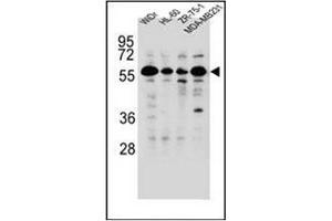 Western blot analysis of FOXC2 Antibody  in WiDr,HL-60,ZR-75-1,MDA-MB231 cell line lysates (35ug/lane). (FOXC2 Antikörper  (Middle Region))