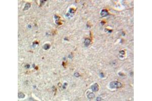 Used in DAB staining on fromalin fixed paraffin-embedded Brain tissue (SCG2 Antikörper  (AA 11-187))