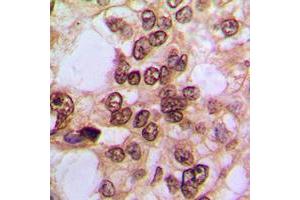 Immunohistochemistry (IHC) image for anti-Nuclear Factor of kappa Light Polypeptide Gene Enhancer in B-Cells 1 (NFKB1) (pSer337) antibody (ABIN7301060)
